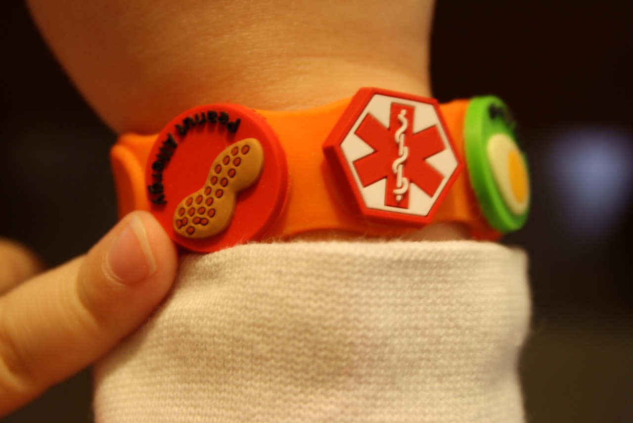 Allergy Friendly Living Part Three – Alert Wristband/Bracelet